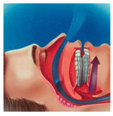 oraldevicesillustration